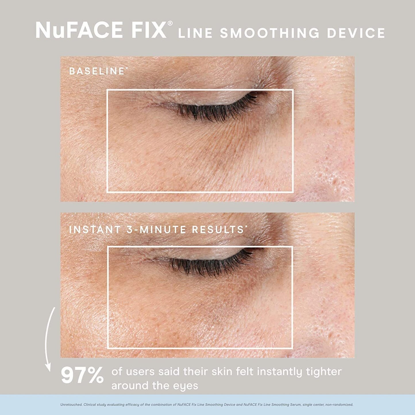 NuFACE FIX Line Smoothing Device & Serum 0.5 oz